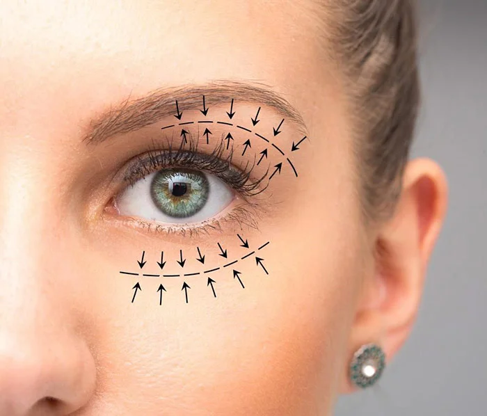 Transform Your Look with Blepharoplasty in Antalya: A Gateway to Beautiful Eyes