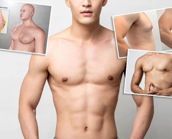 Gynecomastia Surgery in Antalya: Your Ultimate Solution for Achieving a Masculine Physique