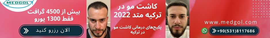 قیمت و پکیج‌های درمانی/سیاحتی کاشت مو در ترکیه