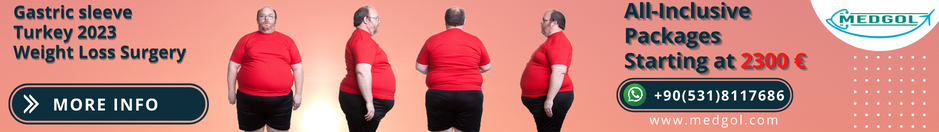 Gastric Sleeve Surgery in Turkey and Weight Loss Surgery Turkey