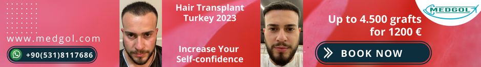 Hair Transplant in Turkey Prices & packages