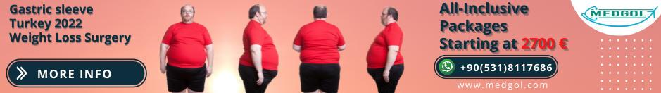 Gastric Sleeve Surgery in Turkey and Weight Loss Surgery Turkey