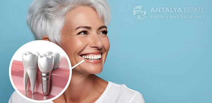 Confident Smile with Dental Implants in Antalya