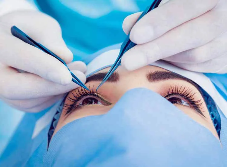 Types of eye surgeries available in Antalya