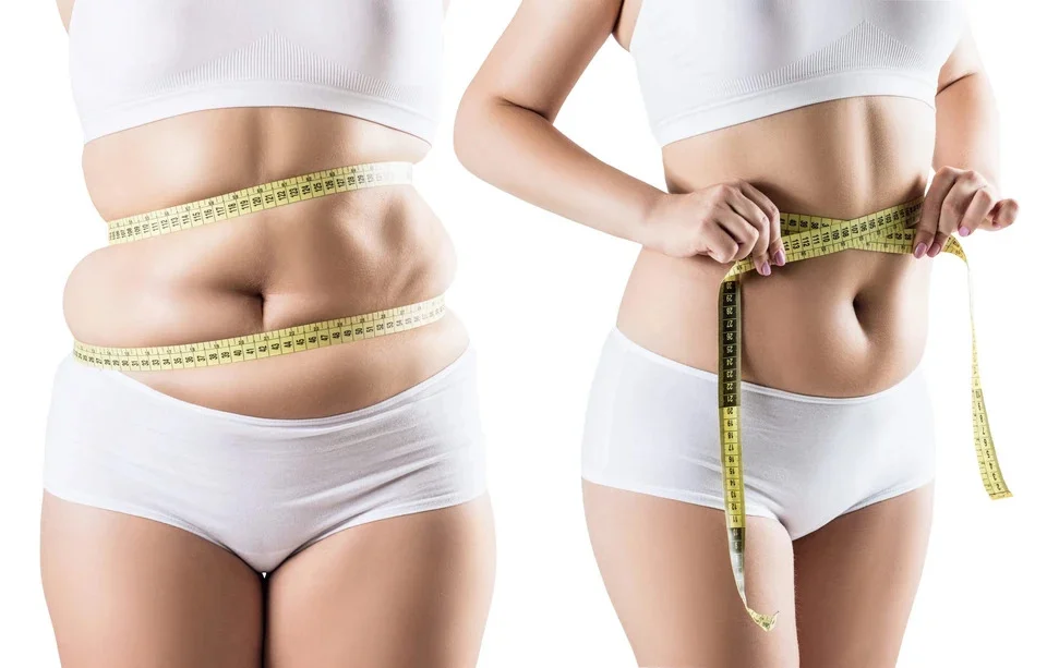 The Liposuction Process in Antalya